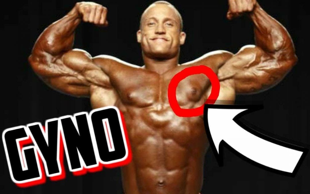 Co je Gyno a jak se zbavit Gyna z steroidů
